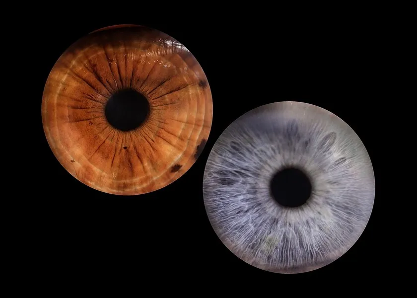 Detailed iris photograph revealing the colour and pattern of an eye
