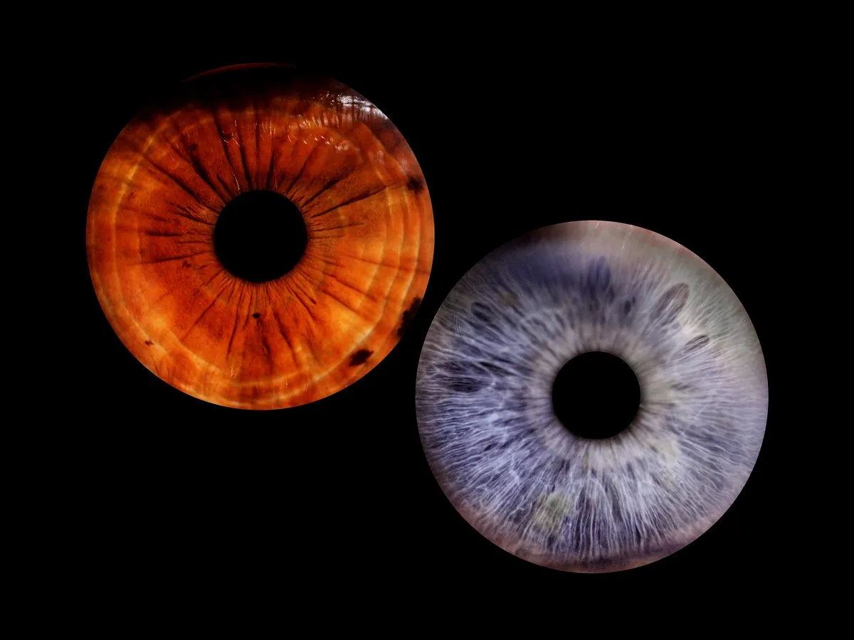 Detailed iris photograph showing the unique colour and pattern of an eye