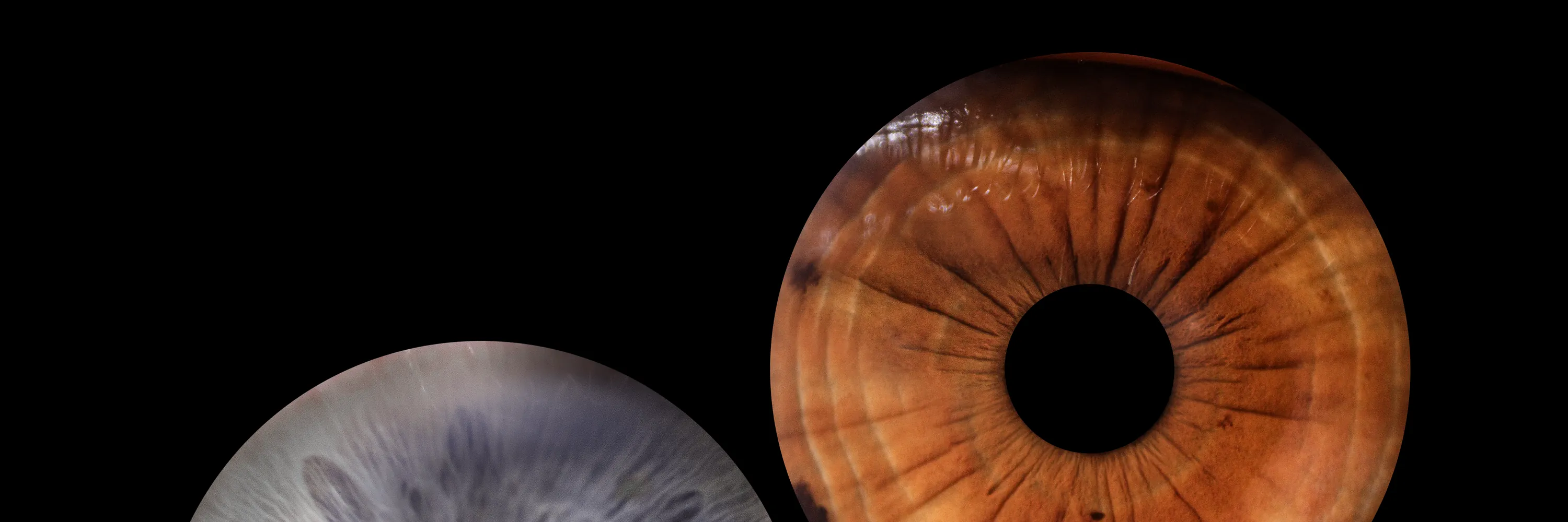 Two detailed iris portraits displayed together against a black background