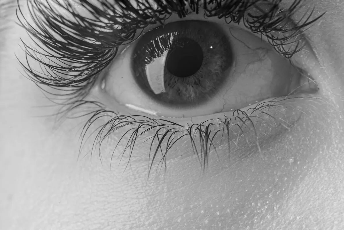 Close-up black-and-white photograph of Thaiss Windenberger’s eye before the iris artwork is created